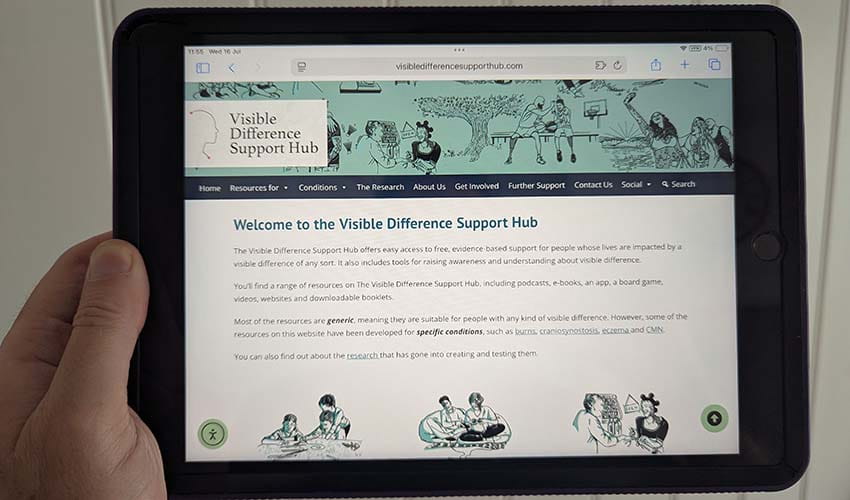 Person holding a tablet computer displaying the website Visible Difference Support Hub